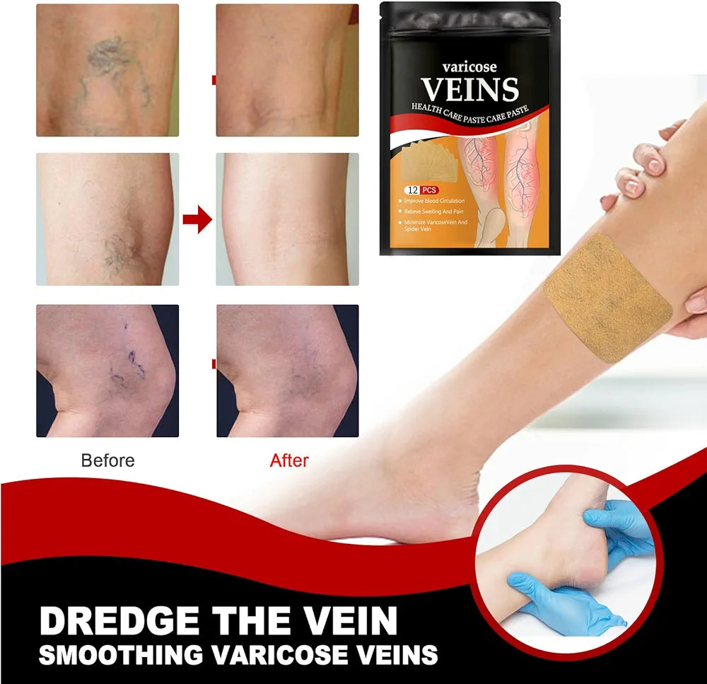 Varis Veins Patches